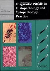 Diagnostic Pitfalls in Histopathology and Cytopathology Practice by Peter P. Anthony