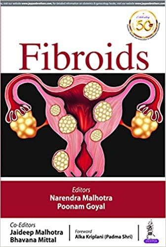 Fibroids 1st Edition 2019 by Narendra Malhotra