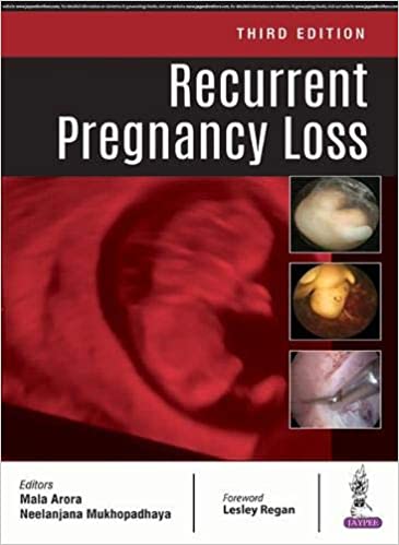 Recurrent Pregnancy Loss 3rd Edition 2019 by Mala Arora