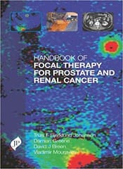 Handbook of Focal Therapy for Prostate and Renal Cancer 1st Edition 2017 by Truls Bjerklund Johansen Handbook of Focal Therapy for Prostate and Renal Cancer 1st Edition 2017 by Truls Bjerklund Johansen