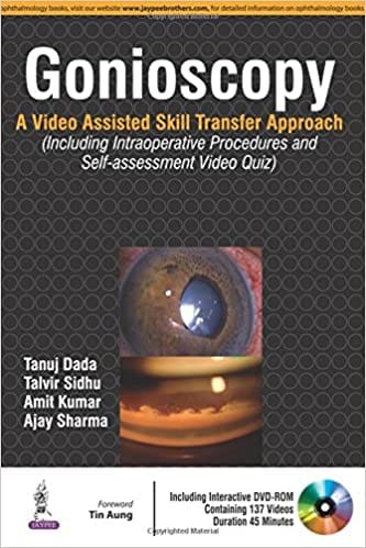 Gonioscopy:A Video Assisted Skill Transfer Approach With Dvd-Rom 2016 by Tanuj Dada