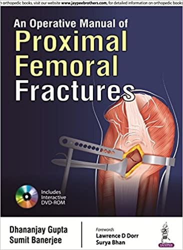 An Operative Manual Of Proximal Femoral Fractures With Dvd-Rom 1st Edition 2016 by Dhananjay Gupta