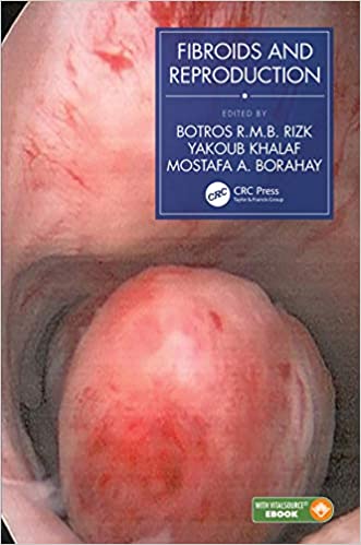 Fibroids And Reproduction 2021 By Botros R.M.B. Rizk