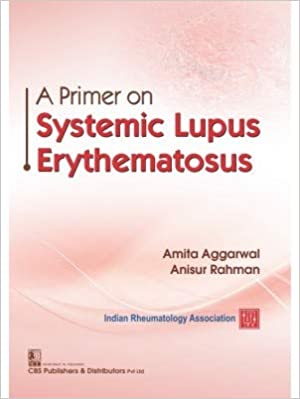 A Primer on Systemic Lupus Erythematosus 2020 by Amita Aggarwal