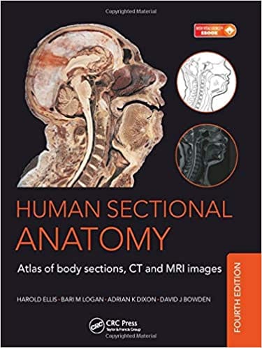 Human Sectional Anatomy Atlas Of Body Sections CT and MRI Images 4th Edition 2015 By Adrian K. Dixon