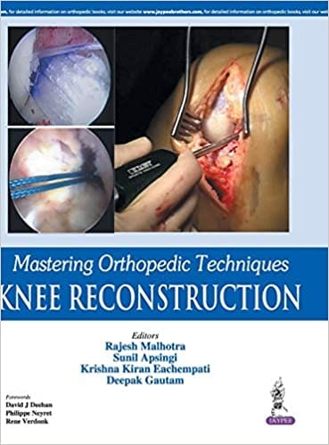 Mastering Orthopedic Techniques Knee Reconstruction 1st Edition 2016 by Rajesh Malhotra