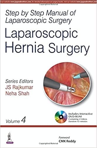 Step By Step Manual Of Laparoscopic Surgery:Laparoscopic Hernia Surgery (Volume 4) 1st Edition 2016 by JS Rajkumar