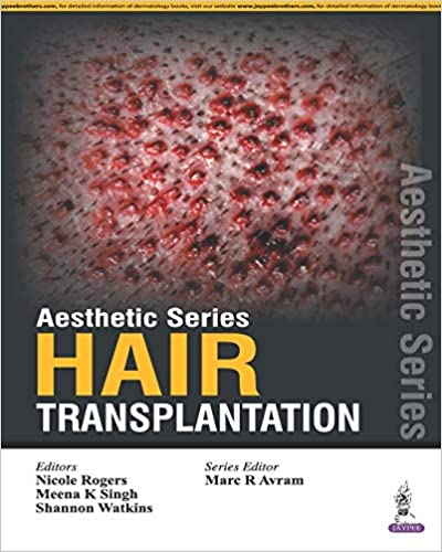 Aesthetic Series Hair Transplantation 1st Edition 2016 by Rogers Nicole