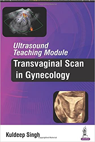 Ultrasound Teaching Module:Transvaginal Scan In Gynecology 1st Edition 2016 by Kuldeep Singh