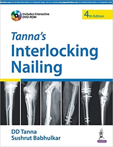 Tanna'S Interlocking Nailing With Dvd-Rom 4th Edition 2016 by Dd Tanna