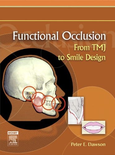 Functional Occlusion From TMJ to Smile Design 1st Edition 2006 by Peter E. Dawson