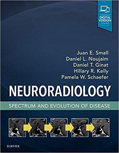Neuroradiology: Spectrum and Evolution of Disease: Spectrum and Evolution of Disease 1st Edition 2020 by Juan E. Small
