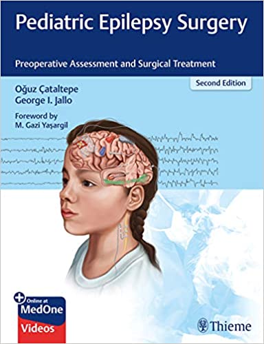 Pediatric Epilepsy Surgery 2nd Edition 2019 by Oguz Cataltepe