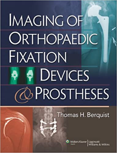 Imaging of Orthopaedic Fixation Devices and Prostheses 2008 by Thomas H. Berquist