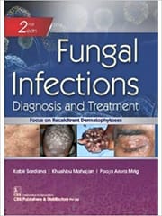 Fungal Infections Diagnosis And Treatment 2nd Edition 2020 by Kabir Sardana