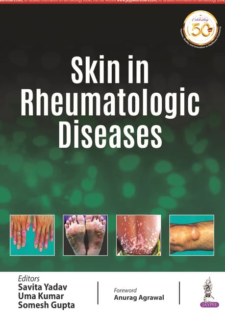 Skin in Rheumatologic Diseases 2021 by Savita Yadav