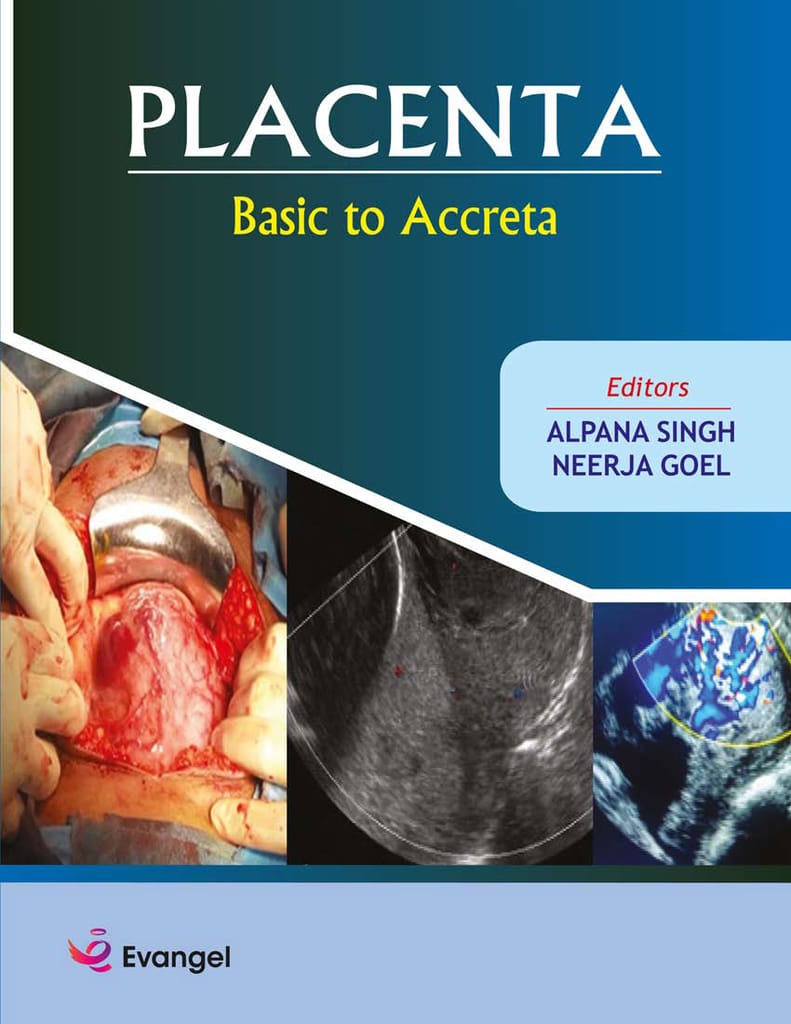 Placenta Basic to Accreta 2020 by Alpana Singh