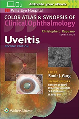 Uveitis (Color Atlas & Synopsis of Clinical Ophthalmology) 2nd Edition 2018 by Sunir J. Garg