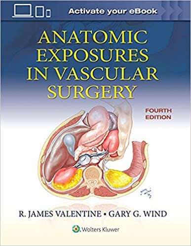 Anatomic Exposures in Vascular Surgery 4th Edition 2021 by R. James Valentine