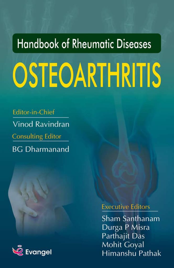 Handbook of Rheumatic Diseases Osteoarthritis 1st Edition 2020 By Vinod Ravindran