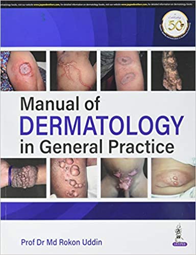 Manual of Dermatology in General Practice 1st Edition 2021 by Dr. MD Rokon