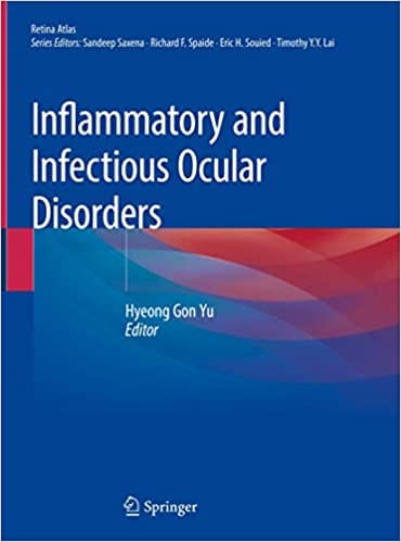 Inflammatory and Infectious Ocular Disorders 2019 by Hyeong Gon Yu