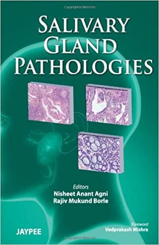 Salivary Gland Pathologies 2013 by Borle Agni Nisheet Anant
