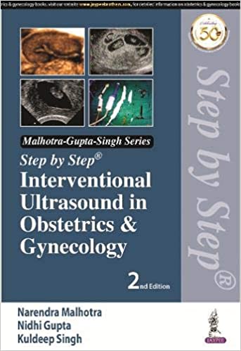 Step by Step Interventional Ultrasound in Obstetrics and Gynecology 2nd Edition 2020 by Narendra Malhotra