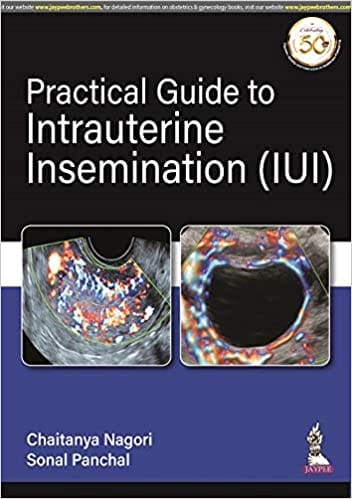 Practical Guide to Intrauterine Insemination 1st Edition 2020 by Chaitanya Nagori & Sonal Panchal