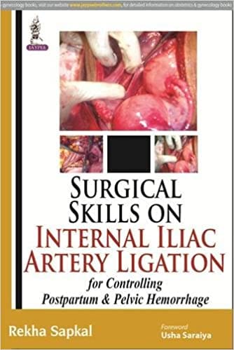 Surgical Skills on Internal Iliac Artery Ligation 1st Edition 2009 by Sapkal Rekha