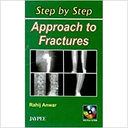 Step By Step Approach to Fractures with CD-ROM 2005 By Anwar