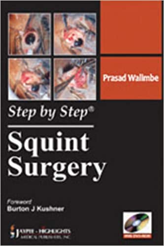 Step By Step Squint Surgery 2011 by Walimbe