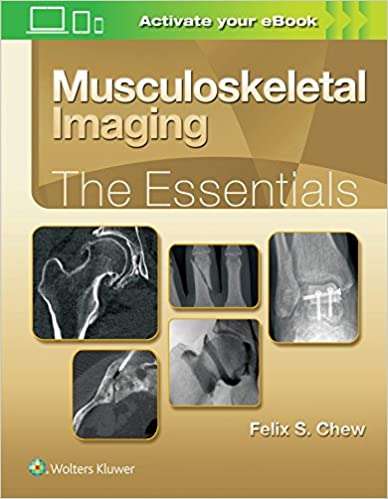 Musculoskeletal Imaging The Essentials 2019 by Felix S. Chew