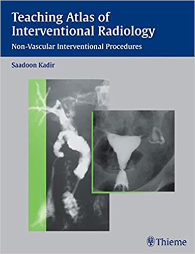 Teaching Atlas of Interventional Radiology: Non-vascular Interventional Procedures by Saadoon Kadir