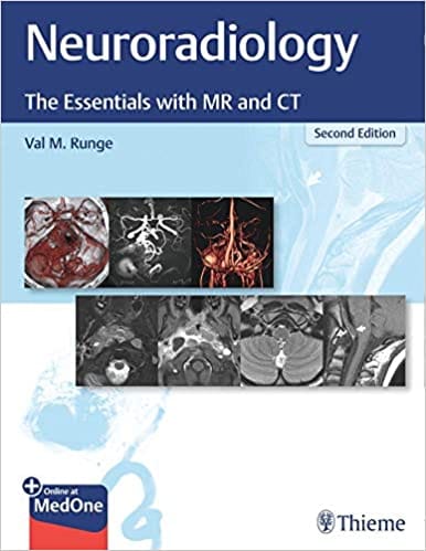 Neuroradiology: The Essentials with MR and CT 2nd Edition 2020 by Val M Runge