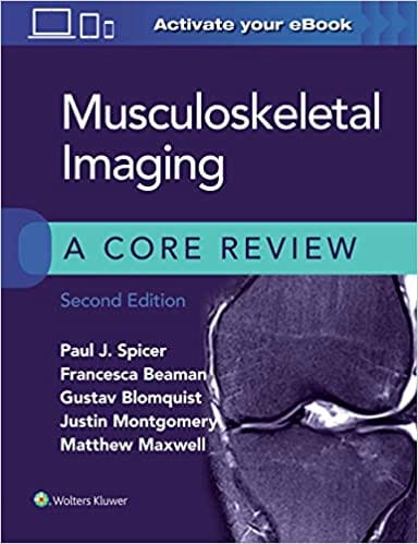 Musculoskeletal Imaging: A Core Review 2nd Edition 2021 by Paul Spicer