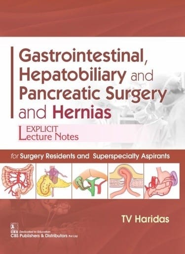 Gastrointestinal, Hepatobiliary And Pancreatic Surgery And Hernias 2021 By T V Haridas