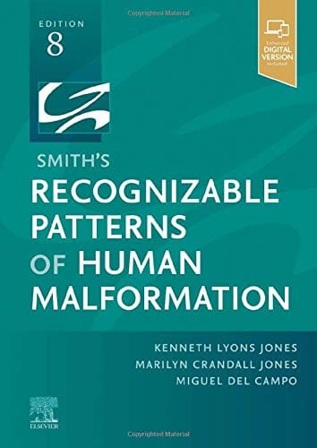 Smith's Recognizable Patterns of Human Malformation 8th edition 2021 by Jones