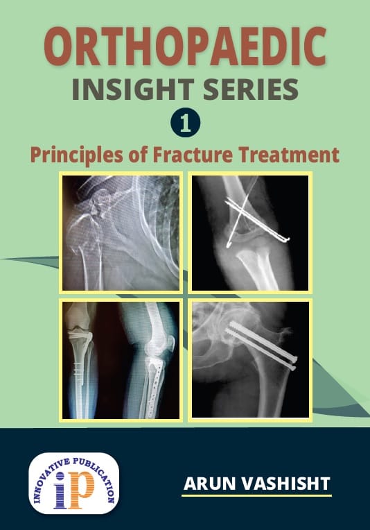 Orthopaedic Insight Series 1 : Principles of Fracture Treatment, First Edition, 2020, By Arun Vashisht