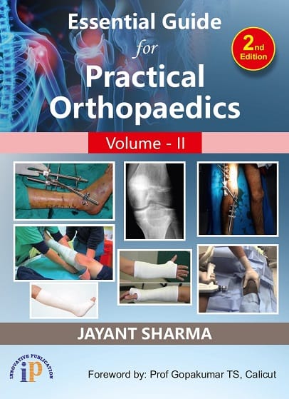 Essential Guide for Practical Orthopaedics - Vol II, Second Edition, 2020, By  Jayant Sharma