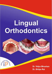 Lingual Orthodontics, First Edition, 2021, By Dr. Vidya Bhushan, Dr. Shilpa Rai