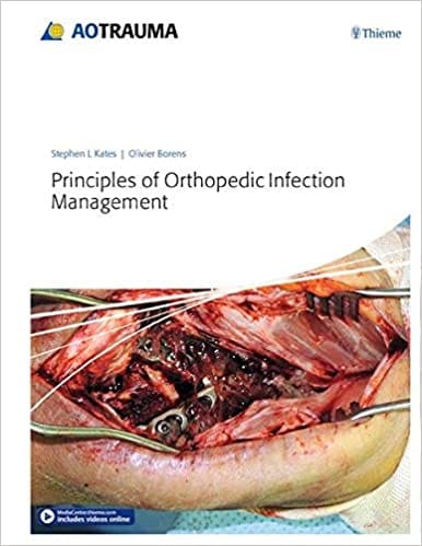 Principles of Orthopedic Infection Management 2016 By Kates S L