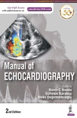 Manual of Echocardiography 2nd Edition 2022 By Navin C Nanda