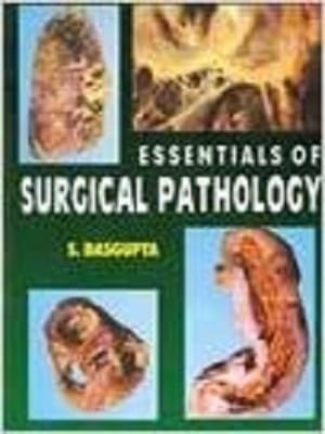 Essential of Surgical Pathology By S. Dasgupta