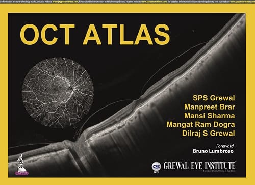 OCT Atlas 1st Edition 2022 By SPS Grewal