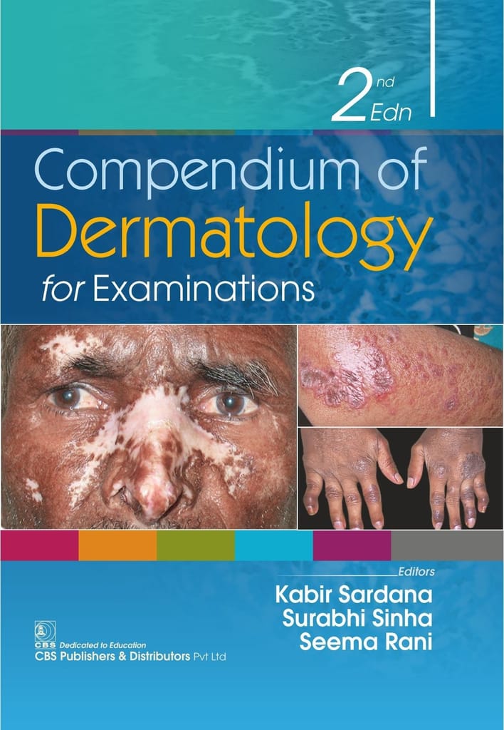 Compendium of Dermatology for Examinations 2nd Edition 2021 By Kabir Sardana