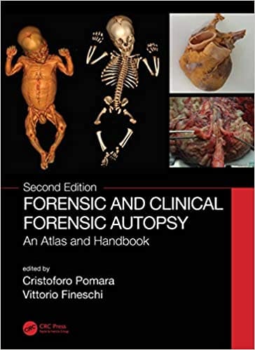 Forensic and Clinical Forensic Autopsy An Atlas and Handbook 2nd Edition 2021 By Cristoforo Pomara