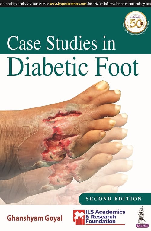 Case Studies in Diabetic Foot (ILS Academics & Research Foundation) 2nd Edition 2022 By Ghanshyam Goyal