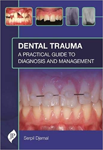 Dental Trauma: A Practical Guide to Diagnosis and Management 1st Edition 2021 by Serpil Djemal