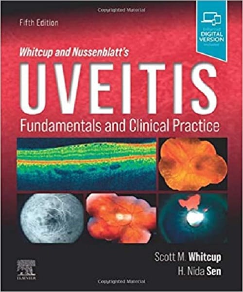 Whitcup and Nussenblatt's Uveitis Fundamentals and Clinical Practice 5th Edition 2021 By Scott M. Whitcup